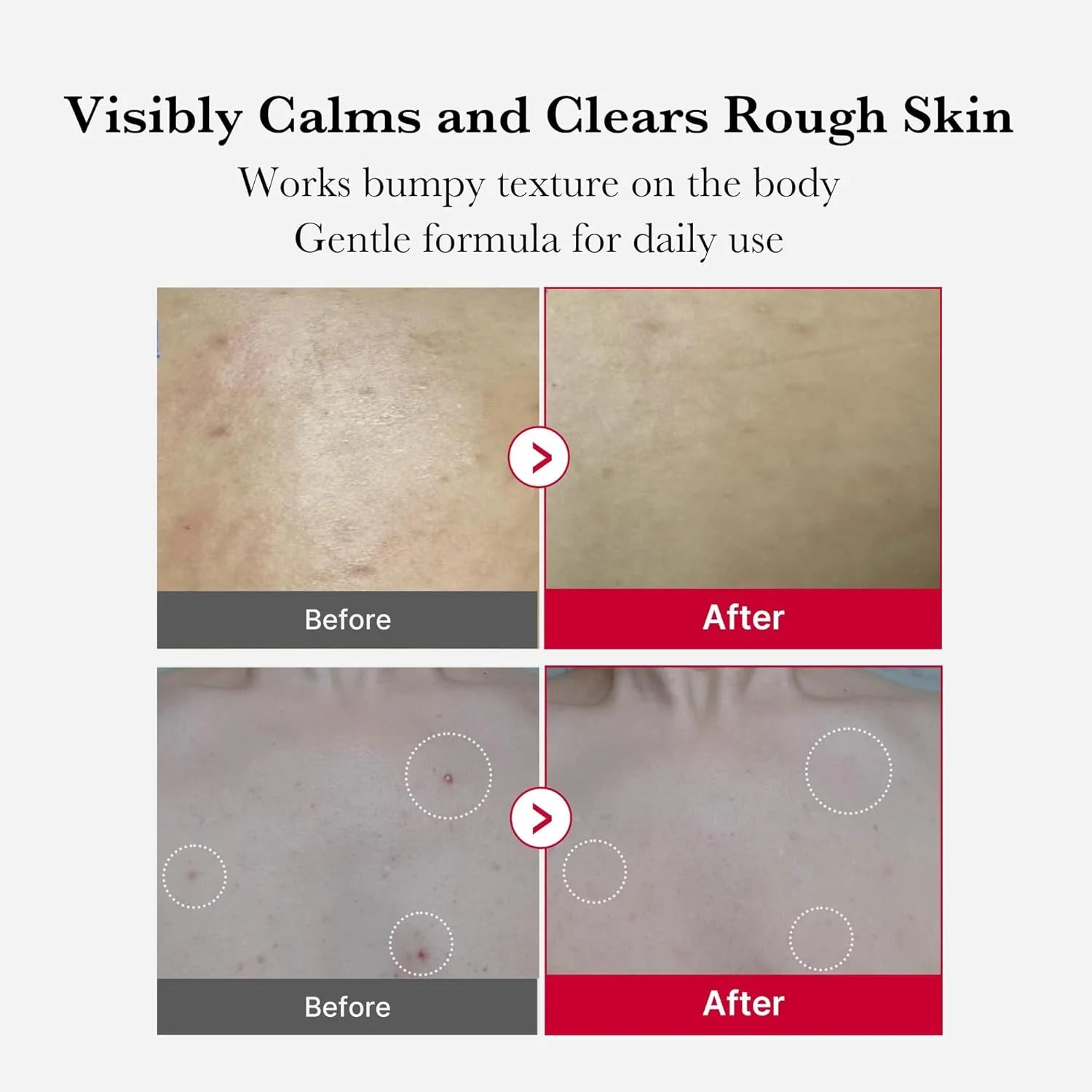 Medicube Red Acne Body Peeling Shot - 110g - gallery image 3