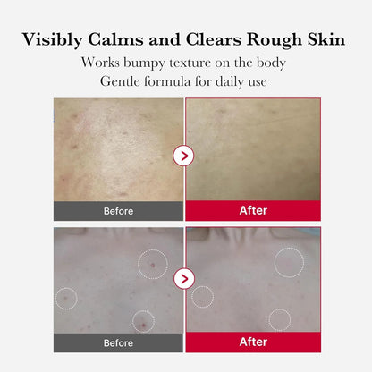 Medicube Red Acne Body Peeling Shot - 110g - gallery image 3